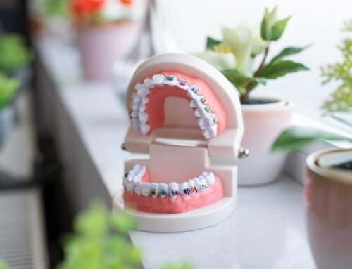 What To Know Before Getting Braces